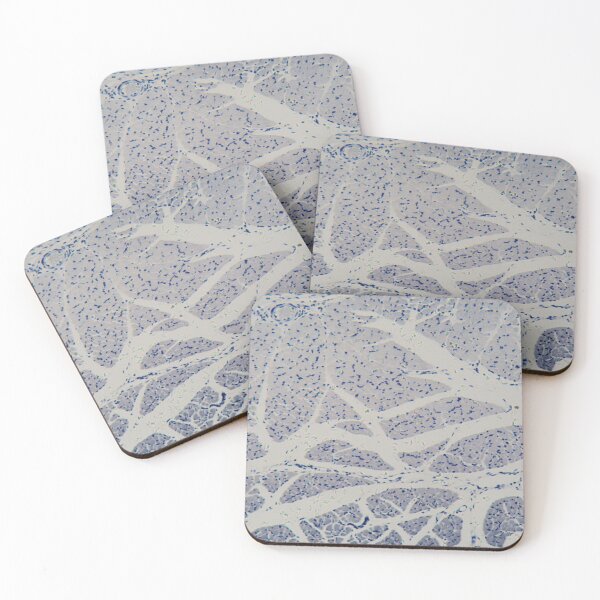 Item preview, Human skeletal muscle cells under the microscope designed and sold by Zosimus.