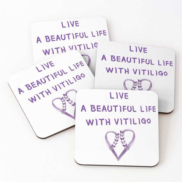 Item preview, Live a beautiful life with vitiligo  designed and sold by karimaK-71.