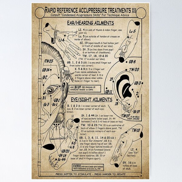 Item preview, Acupuncture Treatment designed and sold by DaleSwart.