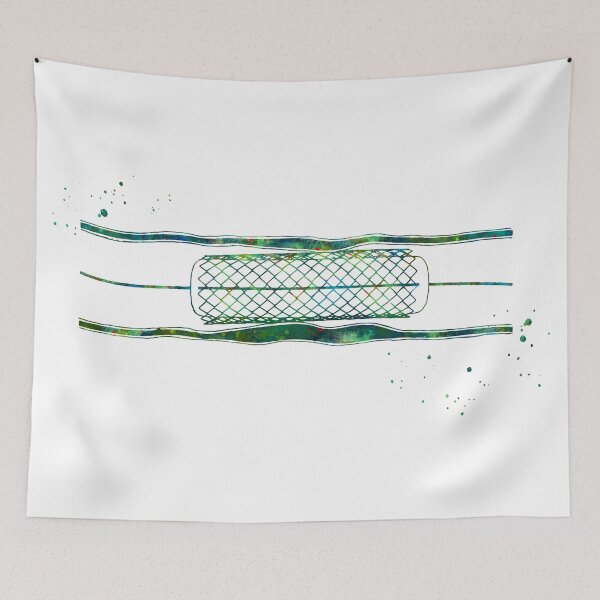Item preview, Coronary Angioplasty Heart Stent designed and sold by EvasDreams.