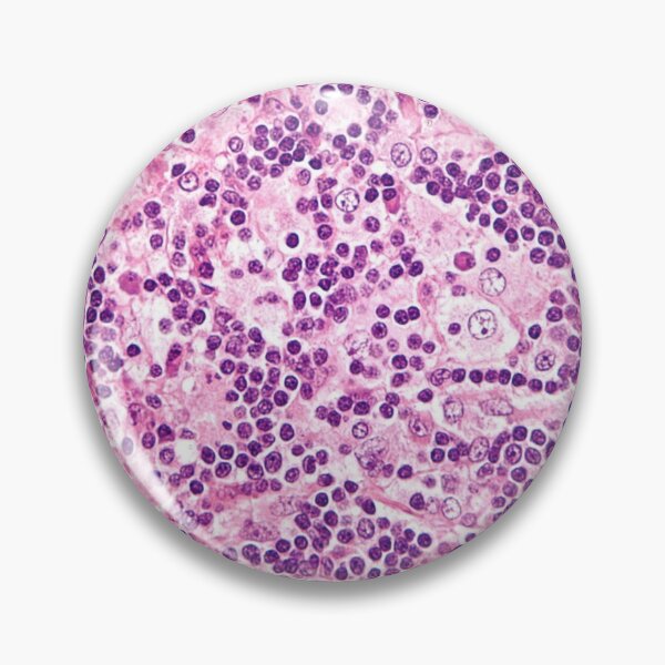 Item preview, Lymph Node Histology designed and sold by deltoid.