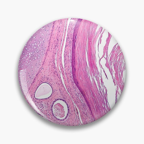 Item preview, Teratoma Histology designed and sold by deltoid.