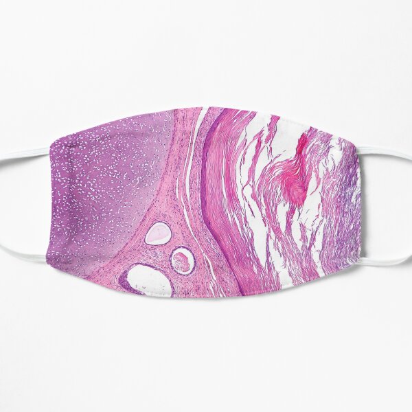 Teratoma Histology Flat Mask