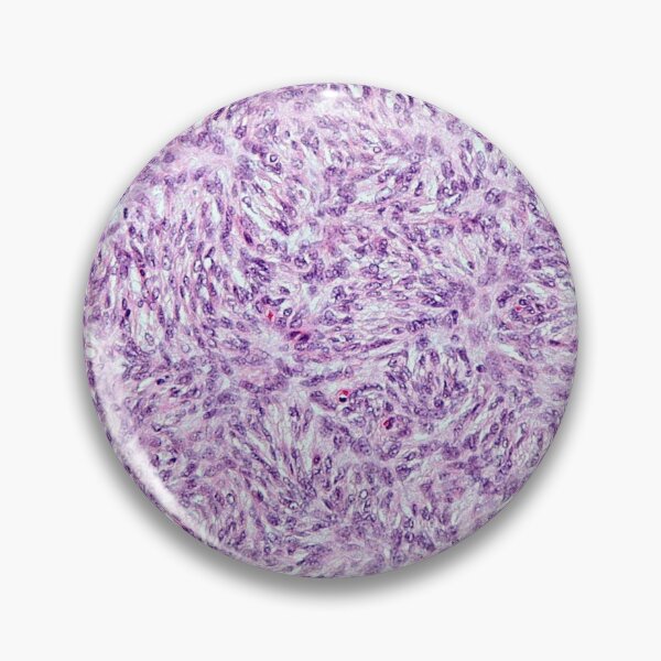 Item preview, Fibroblast Histology designed and sold by deltoid.