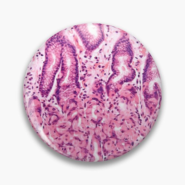 Item preview, Stomach Histology designed and sold by deltoid.