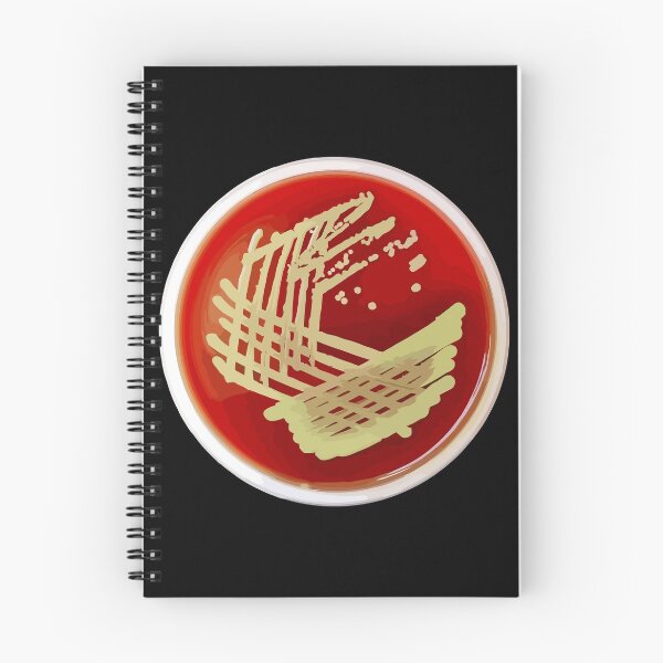 Item preview, Bacterial Culture Streaks E.coli Petri Dish in Microbiology Lab Gold Red Yellow designed and sold by labstud.
