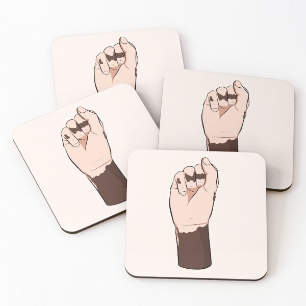 Item preview, Vitiligo hand designed and sold by Popcorn Art.