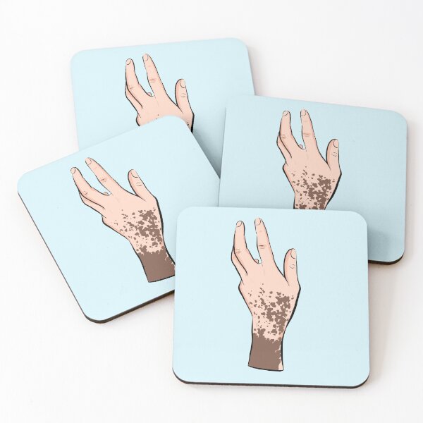 Item preview, Vitiligo hand designed and sold by Popcorn Art.