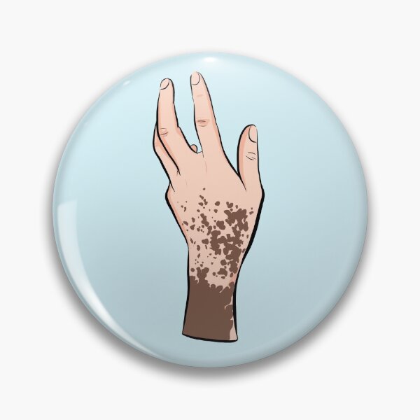 Item preview, Vitiligo hand designed and sold by Popcorn Art.