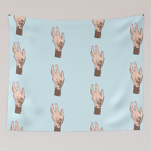 Item preview, Vitiligo hand designed and sold by Popcorn Art.