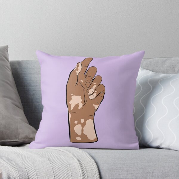 Item preview, Vitiligo hand designed and sold by Popcorn Art.