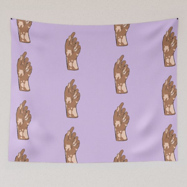 Item preview, Vitiligo hand designed and sold by Popcorn Art.