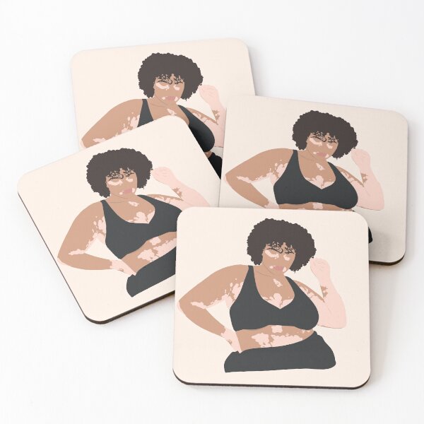 Item preview, Vitiligo designed and sold by Popcorn Art.