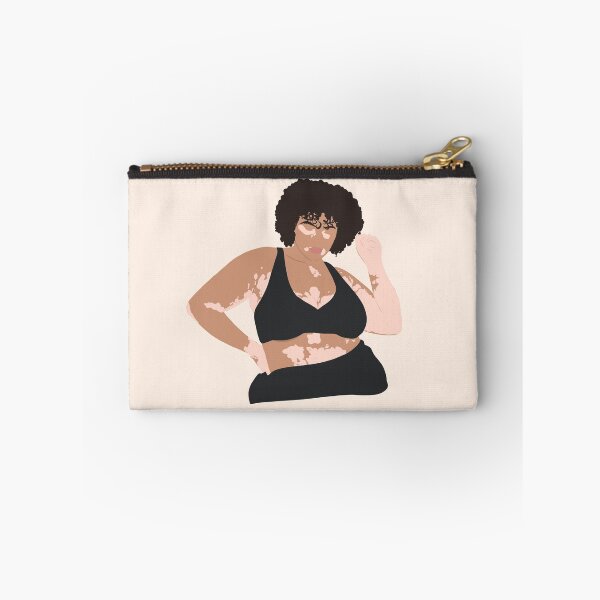 Item preview, Vitiligo designed and sold by Popcorn Art.