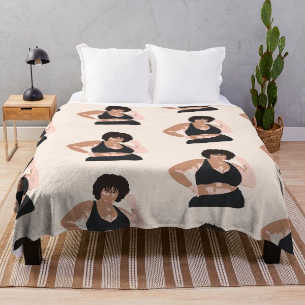 Item preview, Vitiligo designed and sold by Popcorn Art.