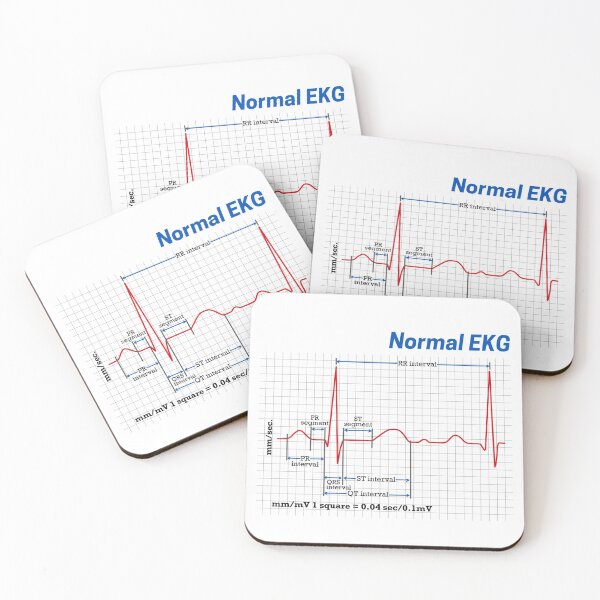 Item preview, Human Heart Normal EKG designed and sold by KARAKATE.