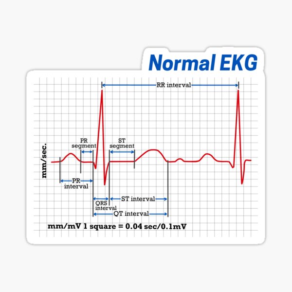 Artikel-Vorschau von Normales EKG des menschlichen Herzens, designt und verkauft von KARAKATE.