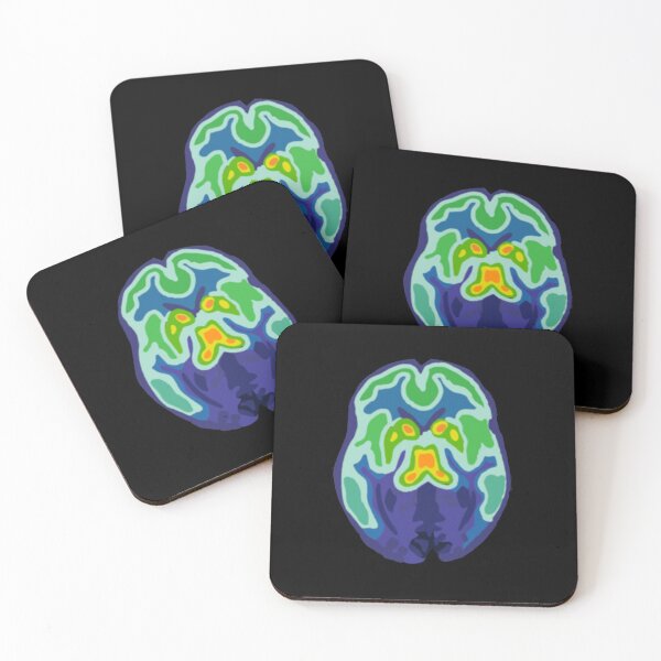 Item preview, Borderline Brain Scan designed and sold by ryleeratliff.