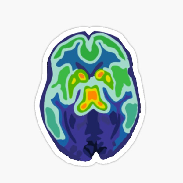 Item preview, Borderline Brain Scan designed and sold by ryleeratliff.