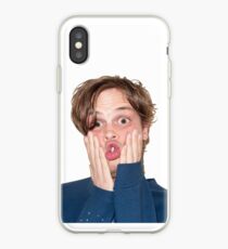 Matthew Gray Gubler Random Picture iPhone Case