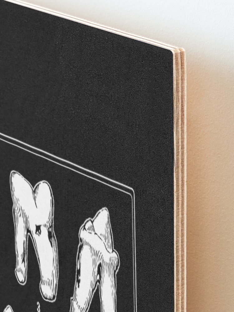 Alternate view of The Tooth Canvas Mounted Print