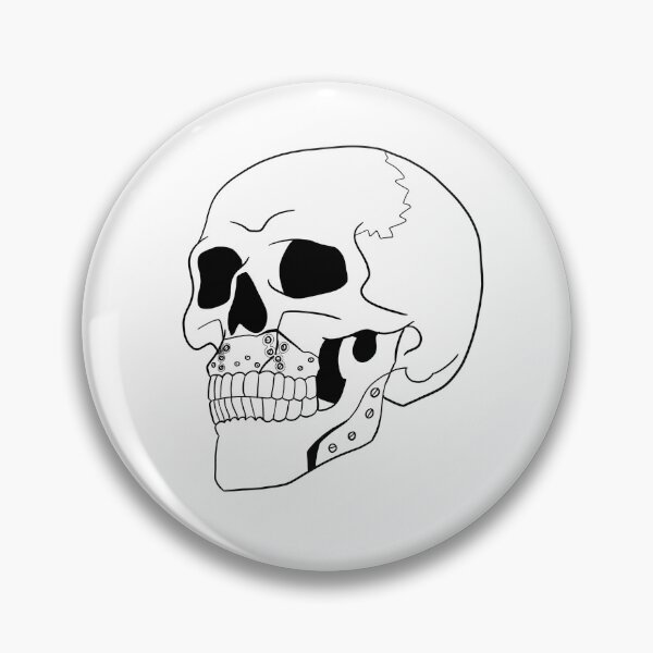 Item preview, Jaw Surgery Skull designed and sold by bayleifdesigns.
