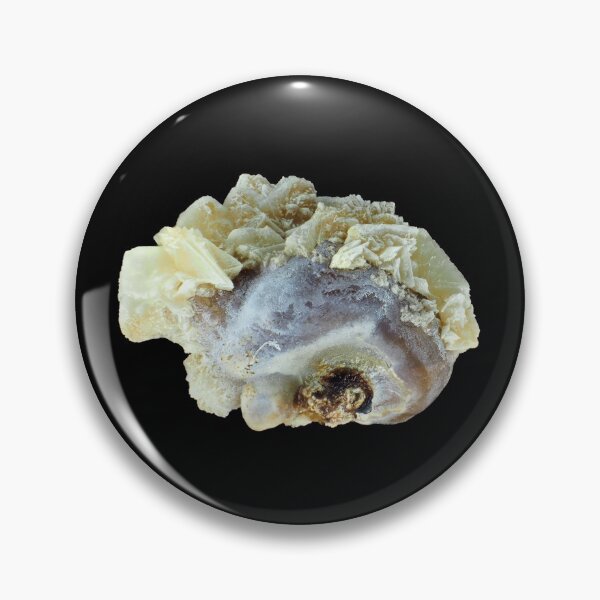 Item preview, Small common human kidney stone designed and sold by SDym Photography.