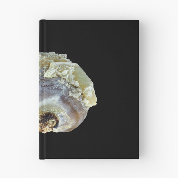 Item preview, Small common human kidney stone designed and sold by SDym Photography.