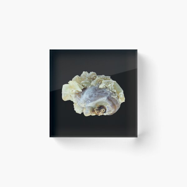 Item preview, Small common human kidney stone designed and sold by SDym Photography.