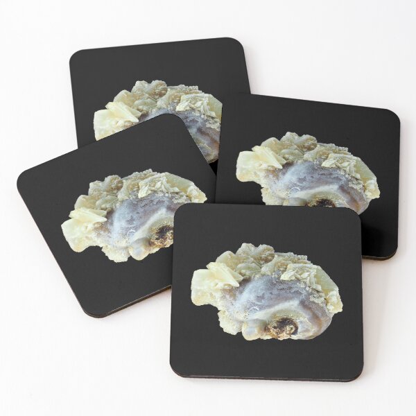 Item preview, Small common human kidney stone designed and sold by SDym Photography.