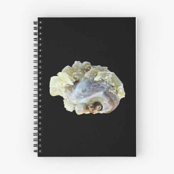 Item preview, Small common human kidney stone designed and sold by SDym Photography.