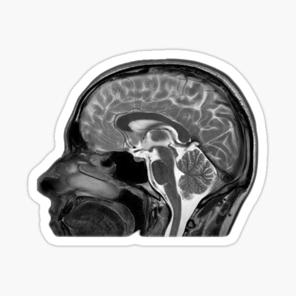 Human Brain Side MR-image Sticker
