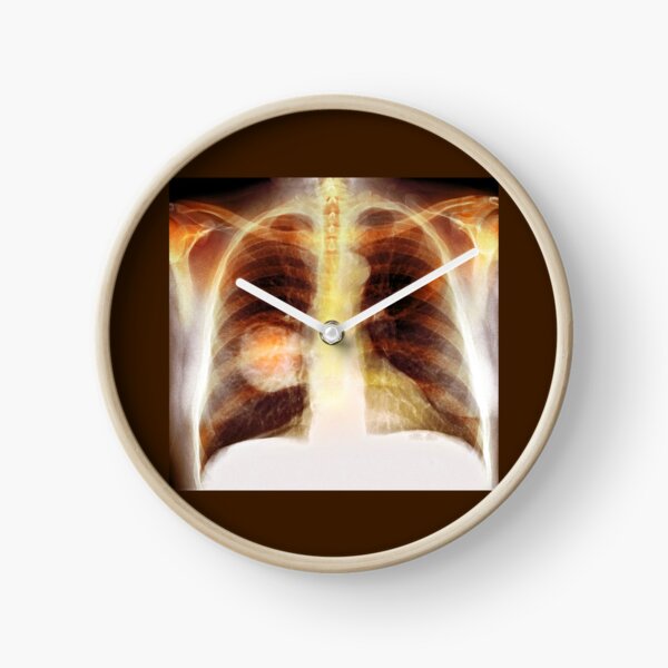 Chest X-Ray Clock