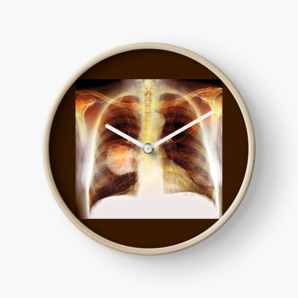 Item preview, Chest X-Ray designed and sold by rcmarble.