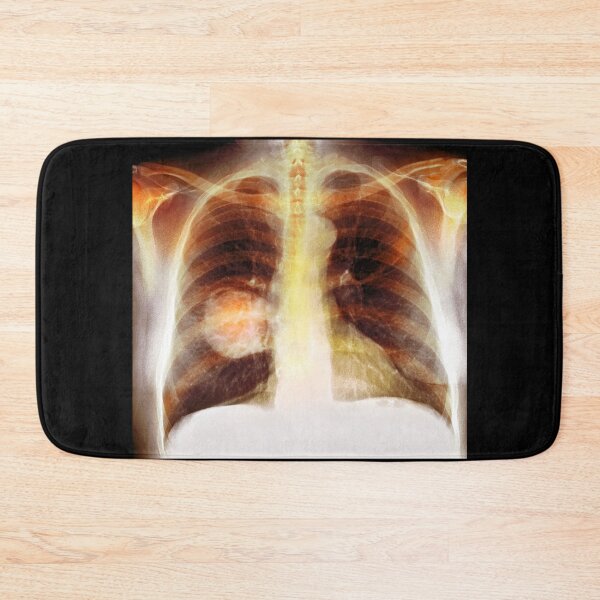 Item preview, Chest X-Ray designed and sold by rcmarble.