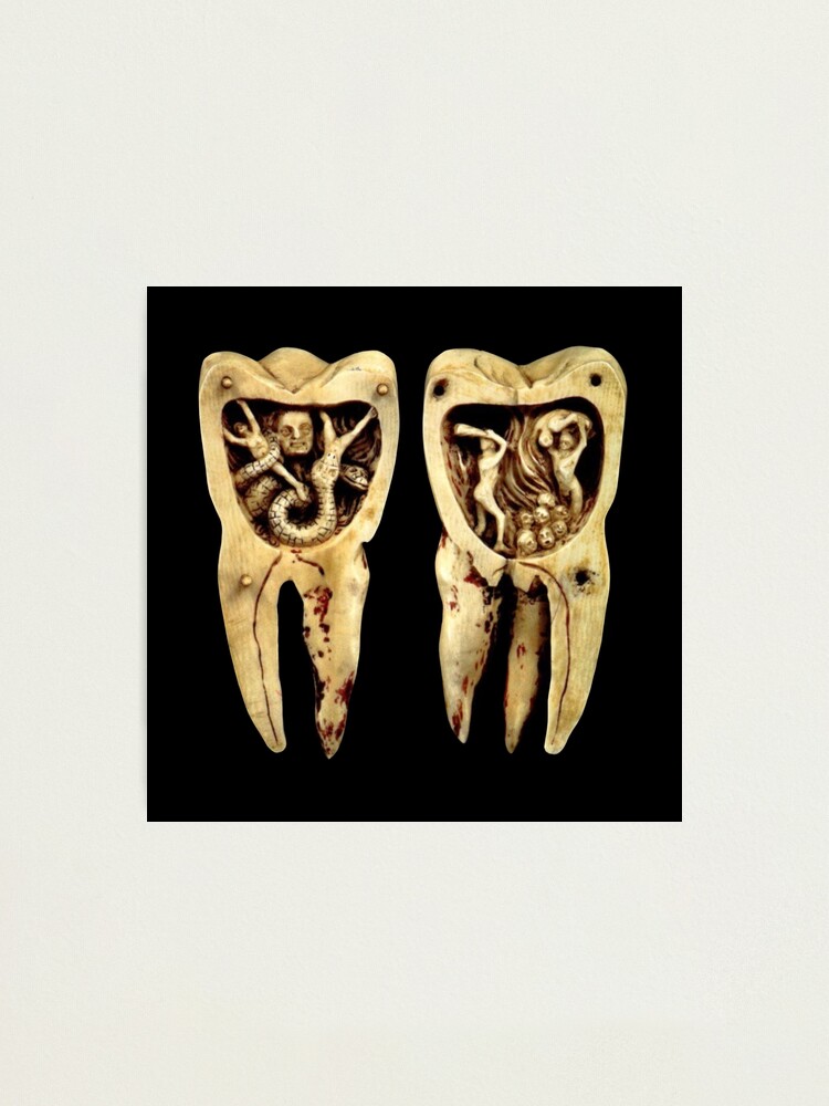 Tooth worm | Photographic Print