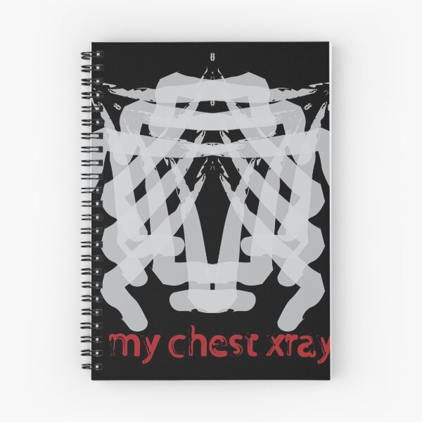 Item preview, x ray designed and sold by Abharan.