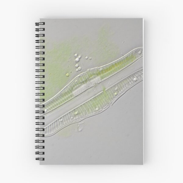Item preview, Freshwater diatom, Rhopalodia sp. designed and sold by SDym Photography.