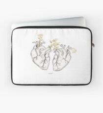 Love Laptop Sleeve