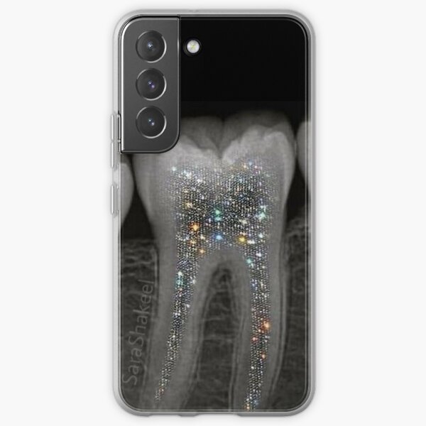 Radiografía dental con purpurina Funda blanda para Samsung Galaxy