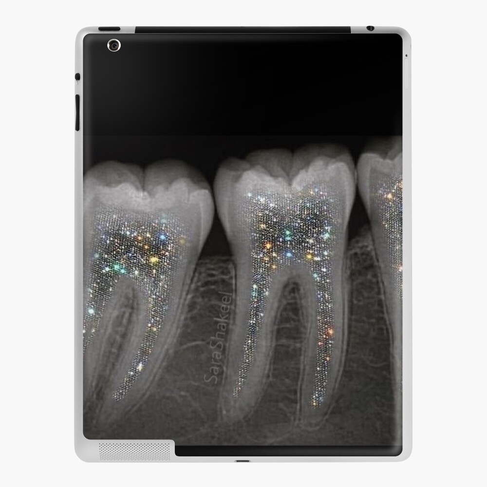 Dental x-ray with glitter