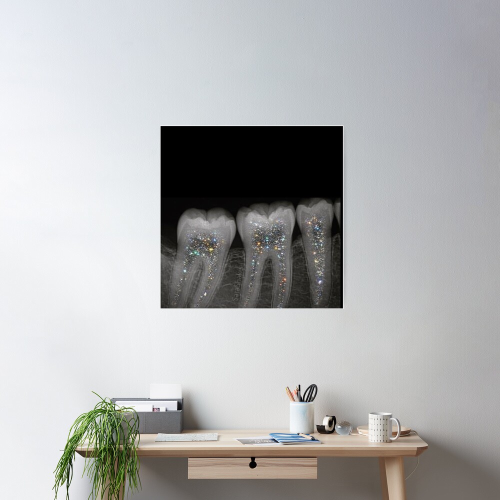 Dental x-ray with glitter