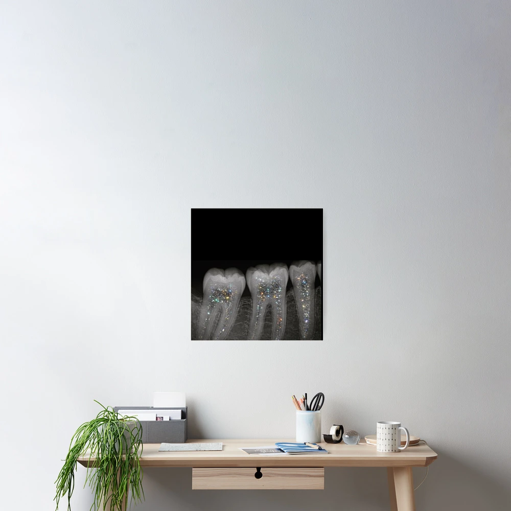 Dental x-ray with glitter