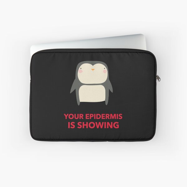 Item preview, Pssst, Your Epidermis is Showing - So Embarrassing designed and sold by Purrfecta.