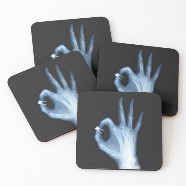 Item preview, Radiography designed and sold by guaka-molly.