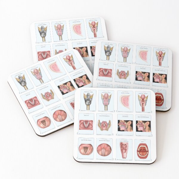 Item preview, SLP  Larynx Fun designed and sold by BlueTreePublish.
