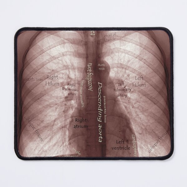Item preview, X ray designed and sold by IschemicNeuron.