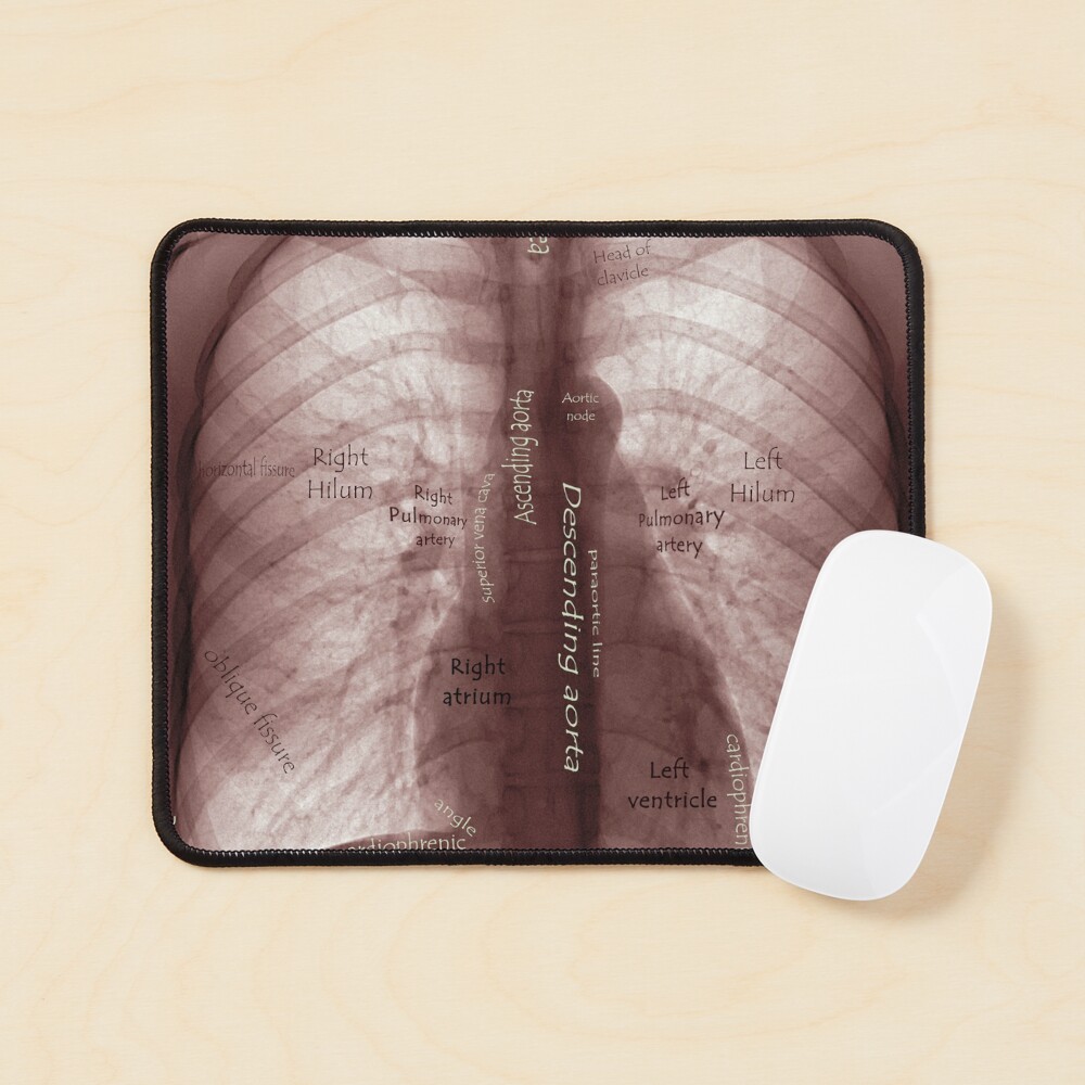 Item preview, Mouse Pad designed and sold by IschemicNeuron.