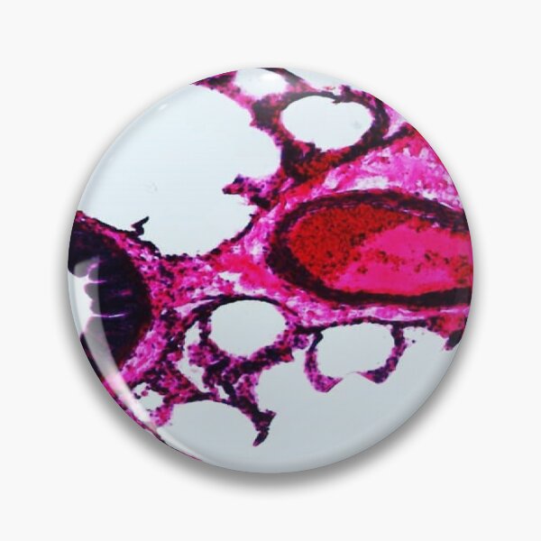 Item preview, Lungs Sec. designed and sold by CellsOfWorld.