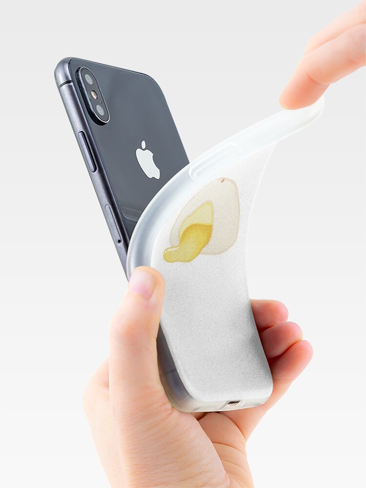Discover Lau Sa Bao -Ryusa -Molten Custom Salted Egg Yolk Bun iPhone Case